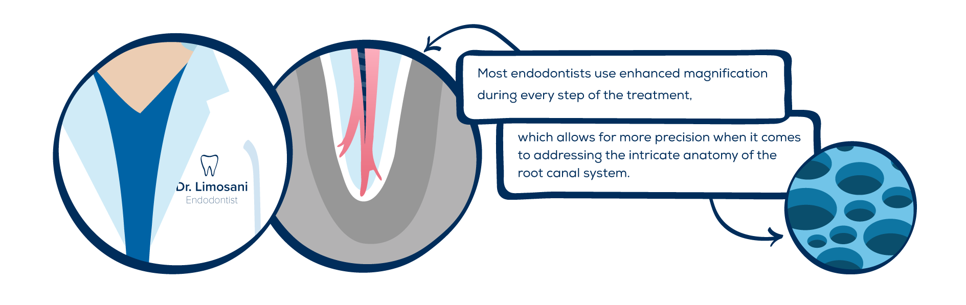 Ask the Endodontist Understanding Your Root Canal Therapy